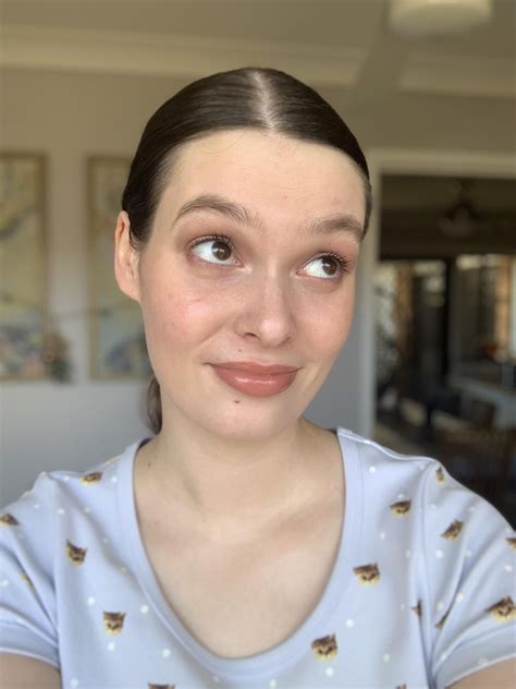 Literally have two popped pimples on my forehead right now, but you