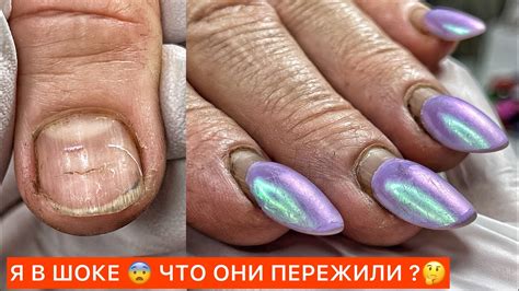 СЛОЖНЫЙ СЛУЧАЙ🚨ФРАНЦУЗСКИЙ МАНИКЮР - YouTube