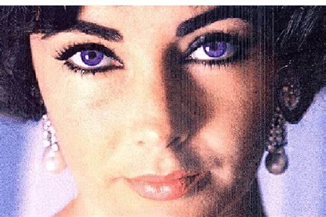 Fotos De Olhos Roxos - 8