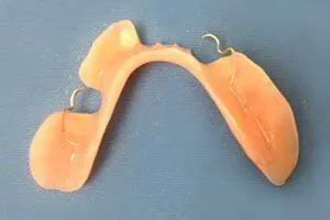 acrylic dentures southside denture clinic