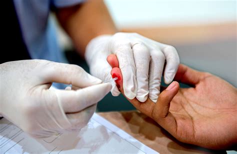 False negative results on HIV tests | aidsmap