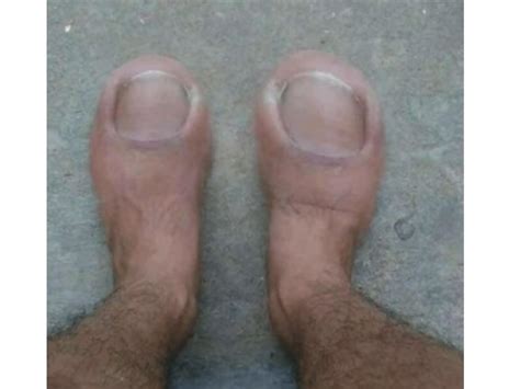 Thanks, I hate toe feet : r/TIHI