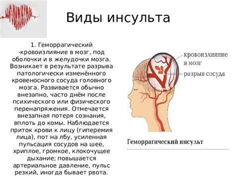 Первая помощь при сердечной недостаточности и инсульте