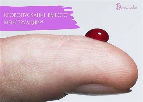 Кровопускание вместо менструации? | Доктор Елена Березовская