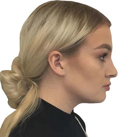 cosmetic surgery plastic surgery breast surgery specialists mya