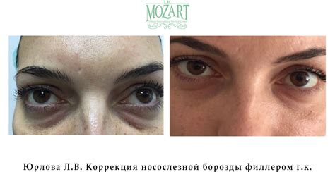 Косметология - фото до и после процедур в Одессе и Украине