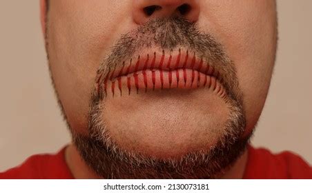 771 Sewn mouth Images, Stock Photos & Vectors | Shutterstock