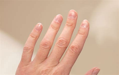 healthy nails  unhealthy nails