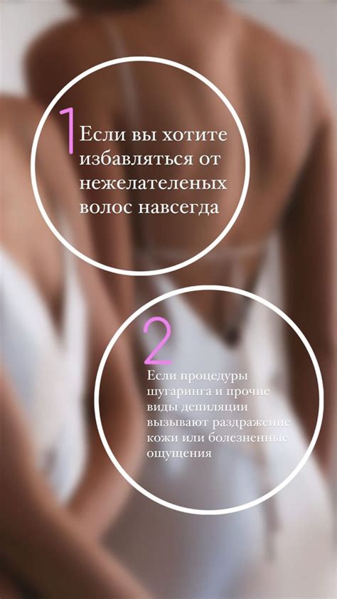 Лазерная эпиляция