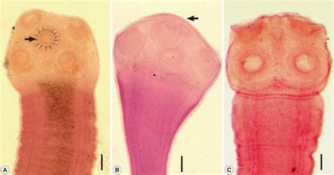 Scolices of human Taenia tapeworms recovered from Korean patients. (A)... | Download Scientific ...