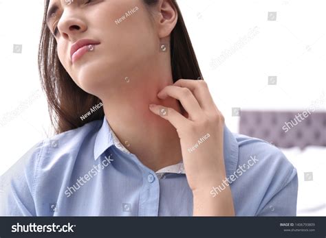 2,480 Neck rash Images, Stock Photos & Vectors | Shutterstock