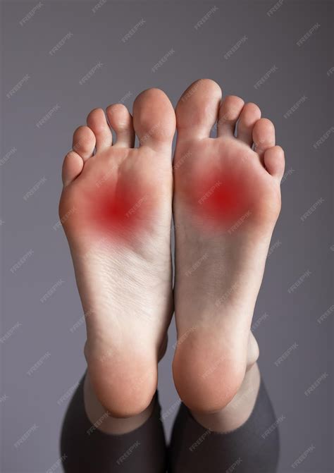 Douleur à la voûte plantaire Inflammation Surutilisation Blessure au