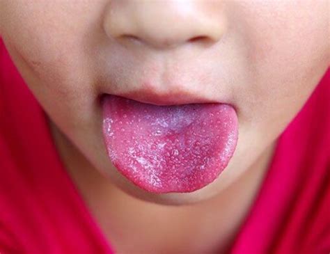Kinderziektes Archieven - Tips voor werkende ouders