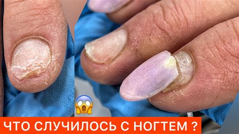 СПАСЕНИЕ НОГТЯ🙈ДЕТИ НА МАНИКЮРЕ🥹 - YouTube