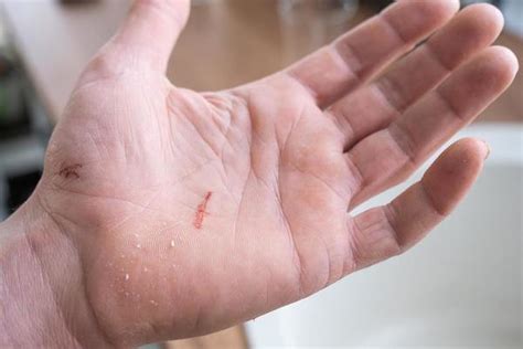 Skin Cut Stock Photos, Images and Backgrounds for Free Download