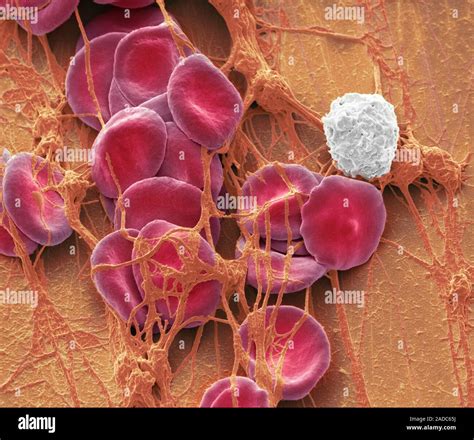 Las células de la sangre humana, color Micrografía análisis de ...