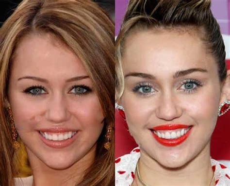 Miley Cyrus Plastic Surgery: Boob Job, Nose Job, Botox