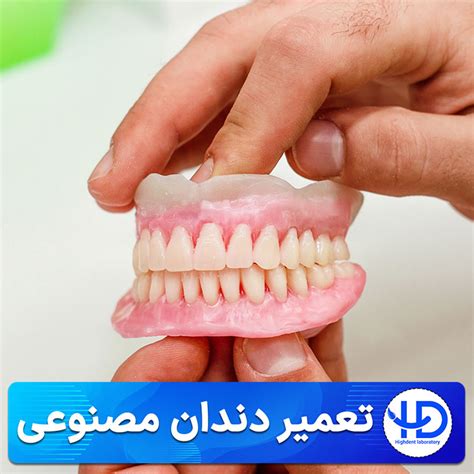 تعمیر دندان مصنوعی شکسته در 2 ساعت | دندانسازی هایدنت