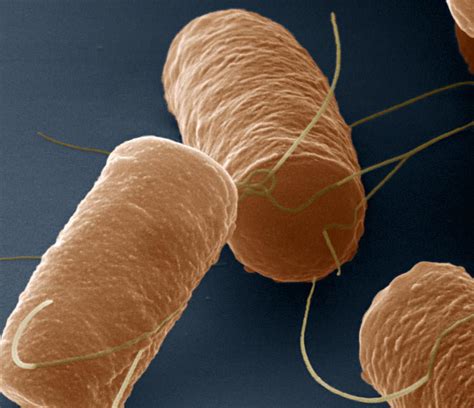 Bacillus cereus food poisoning with foodborne toxins - Best Biology ...