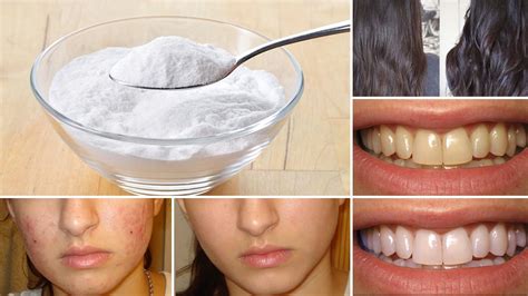 7 Great Benefits Of Baking Soda You Will Love - Youth Village Kenya