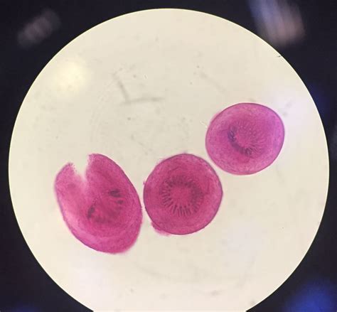 Echinococcus Granulosus Morphology