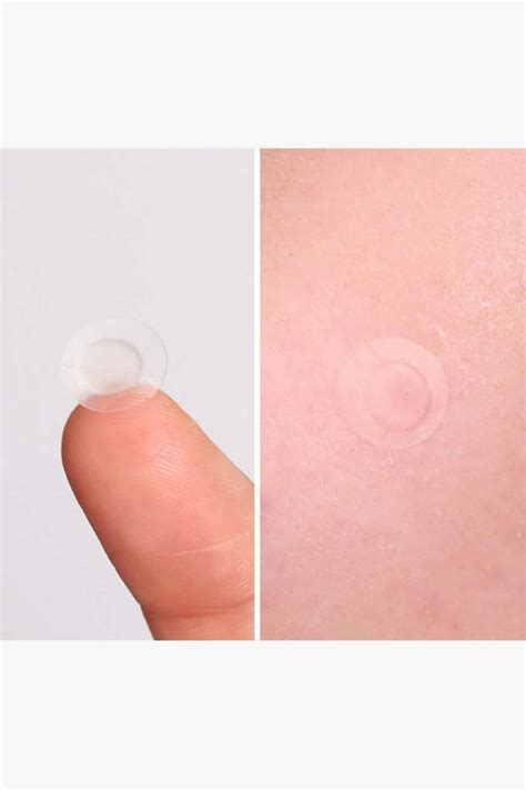 Pyunkang Yul - ACNE Spot Patch (Super Thin) - 1 x 15 patches – Kanvas ...
