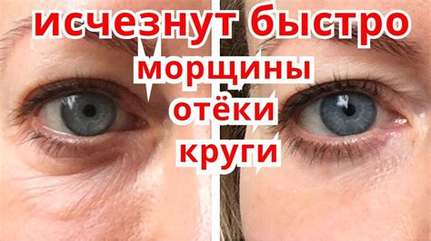 Морщины ВОКРУГ ГЛАЗ Исчезнут Сразу .Уйдут Отёки и круги под Глазами ...