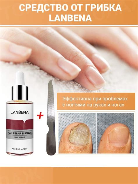 Средство от грибка ногтей на ногах LANBENA / Уход за ногтями, борьба с ...