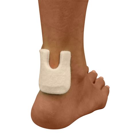 U Shaped Felt Callus Pads - Adhesive Foot Pads That Protect Calluses