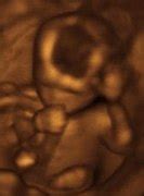 obstetric ultrasonography wikipedia