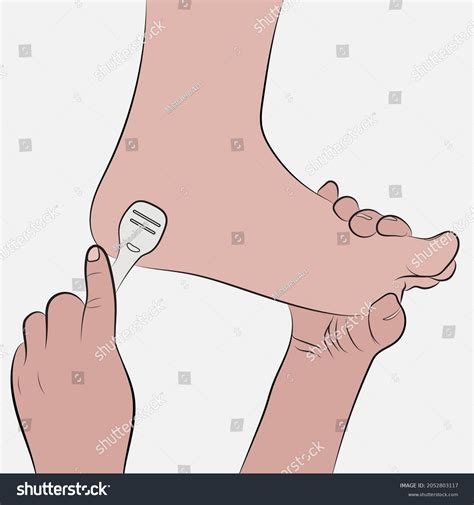 1 Friction Fungus Stock Vectors and Vector Art | Shutterstock