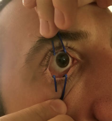 The Mighty Paper Clip — Taming the SRU