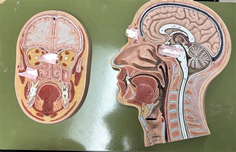 sinus process diagram quizlet