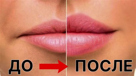 УВЕЛИЧЬ губы за 10 МИНУТ! Лёжа на диване | Как увеличить губы ...