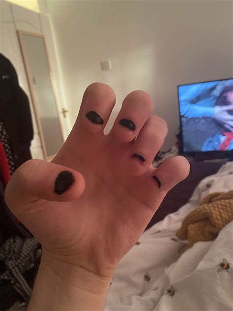 Day 2: just found this sub the other day and decided it was time to