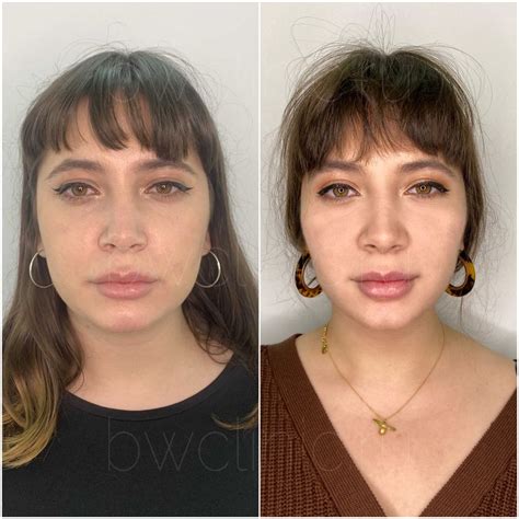Процедуры инъекции липолитиков от 2490 руб/мл - BeautyWay Clinic 8 (499 ...