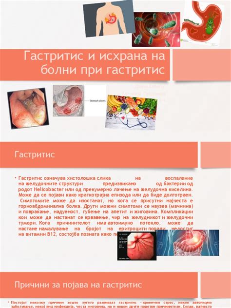 Гастритис и исхрана на болни при гастритис | PDF
