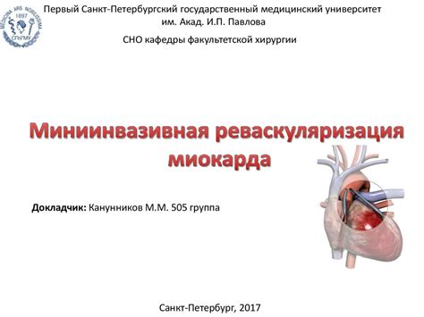 Миниинвазивная реваскуляризация миокарда - презентация онлайн
