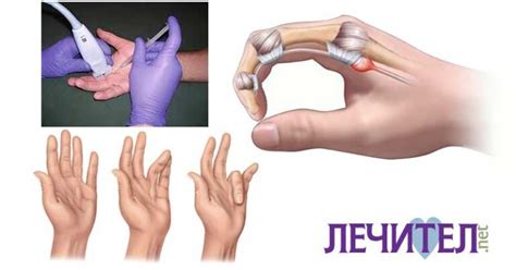 Лечител.net | Най-добрият портал за здраве!