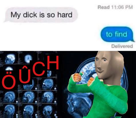 That’s gotta hurt! Profits will ease your pain! Invest! : r/MemeEconomy