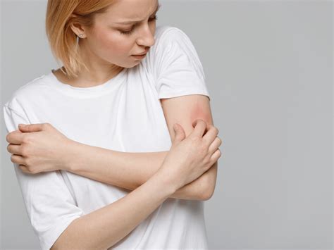 itchy skin academic alliance  dermatology