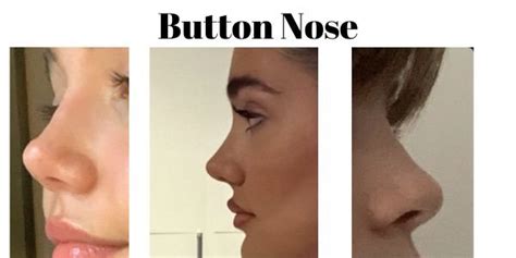 button nose  dental  skin aesthetic medical center  multan