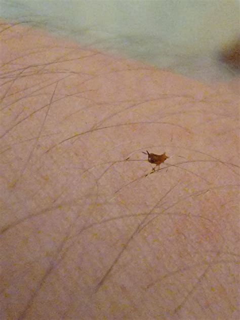 What is this tiny thing? I could feel it walking on my arm hairs. : r