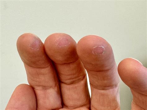 What do your calluses look like?... - Master Guitar Academy