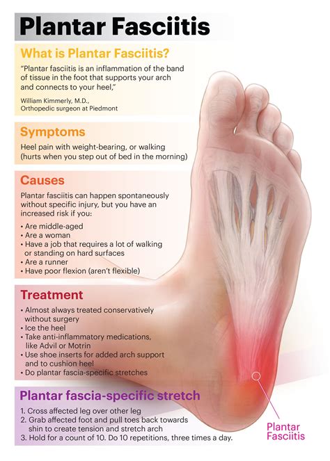 Plantar Fasciitis Symptoms