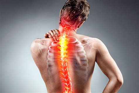 osteokhondroz | Академия Кайдзен