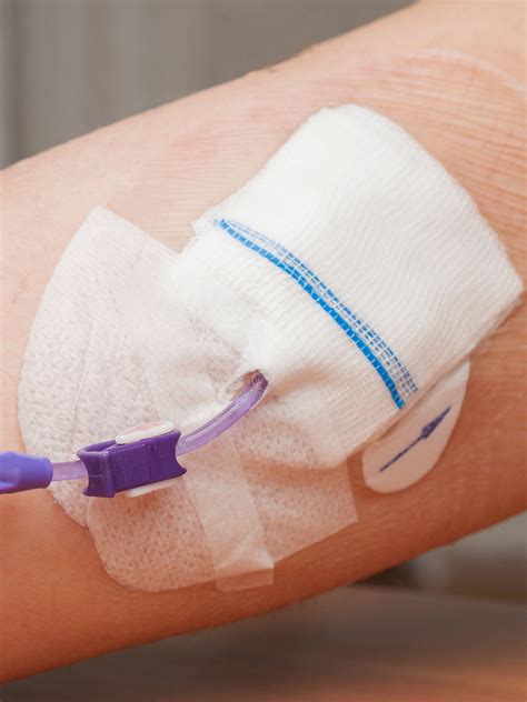 midline catheter versus picc line 4