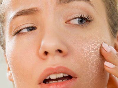 6 признаков дефицита кальция, которые нельзя игнорировать!