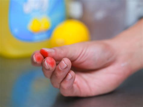 Does Food Colouring In Water Stain Skin at Abbey Wales blog