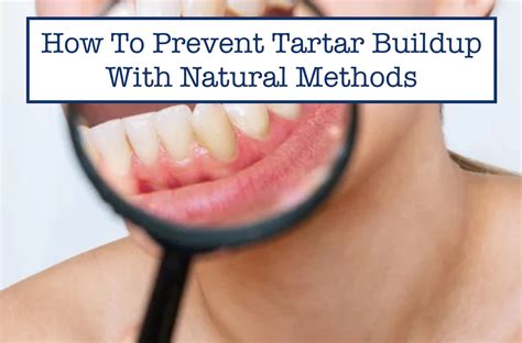 prevent tartar buildup  natural methods